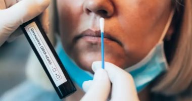 ما هى قيمة Ct فى اختبار  RT-PCR لمرضى كورونا؟