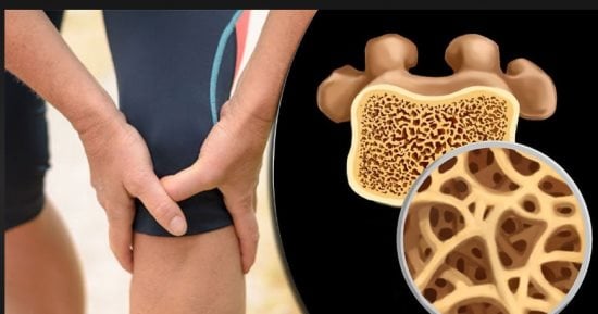 أعراض وأسباب نقص الفسفور فى الجسم