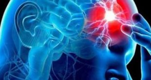 استخدام الموبايل أكبر الأسباب.. كل ما تريد معرفته عن الصداع النصفي لدى الأطفال